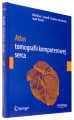 Atlas tomografii komputerowej serca